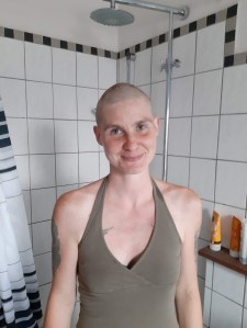 mein persönlicher Haarverlust am 6.Aug 2019